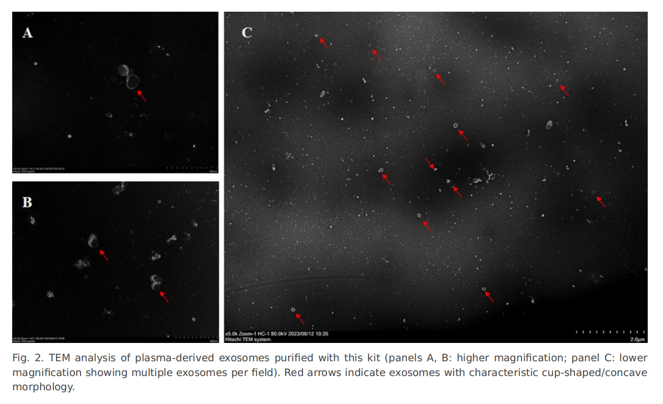 EXOBX® Magnetic EV/Tissue/Plasma miRNA Kit R1309 Performance